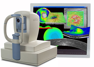 OCT : Ocular Coherence Tomography